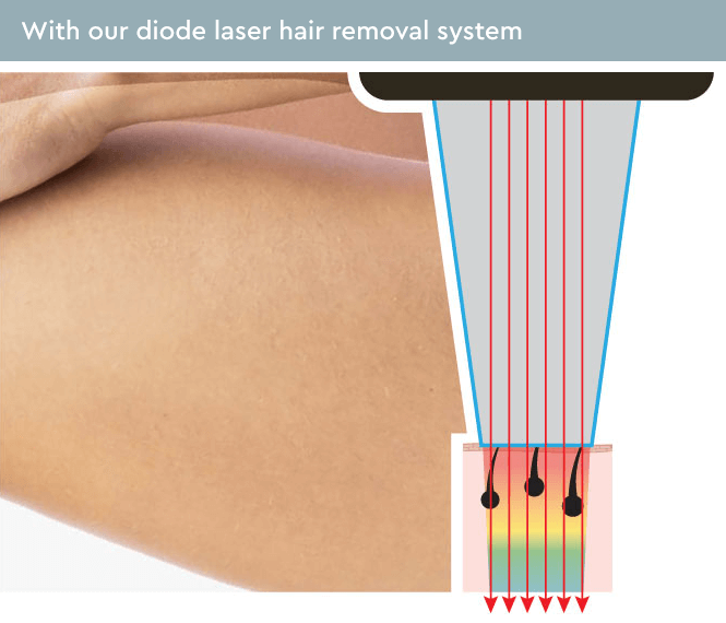 Laser On Tour - laserontour.com