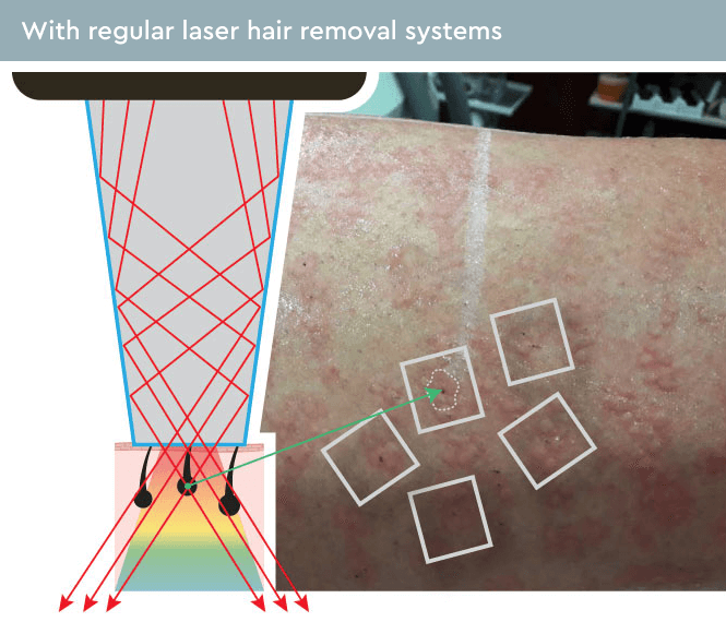 Laser On Tour - laserontour.com